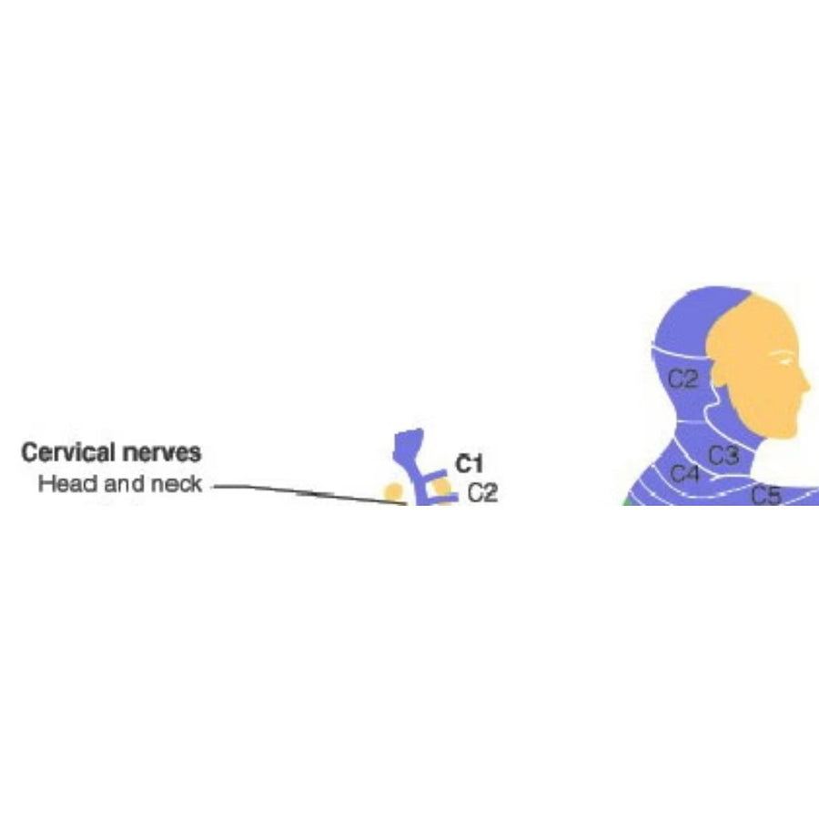 SCI - Spinal Cord Injury - C1 & C2 Quadriplegia